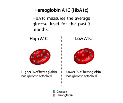 An image showing text reading: 'Hemoglobin A1C(Hb1Cc) HbA1c measures the average glucose level for the past 3 months.' And a picture of High A1C and Low A1C.