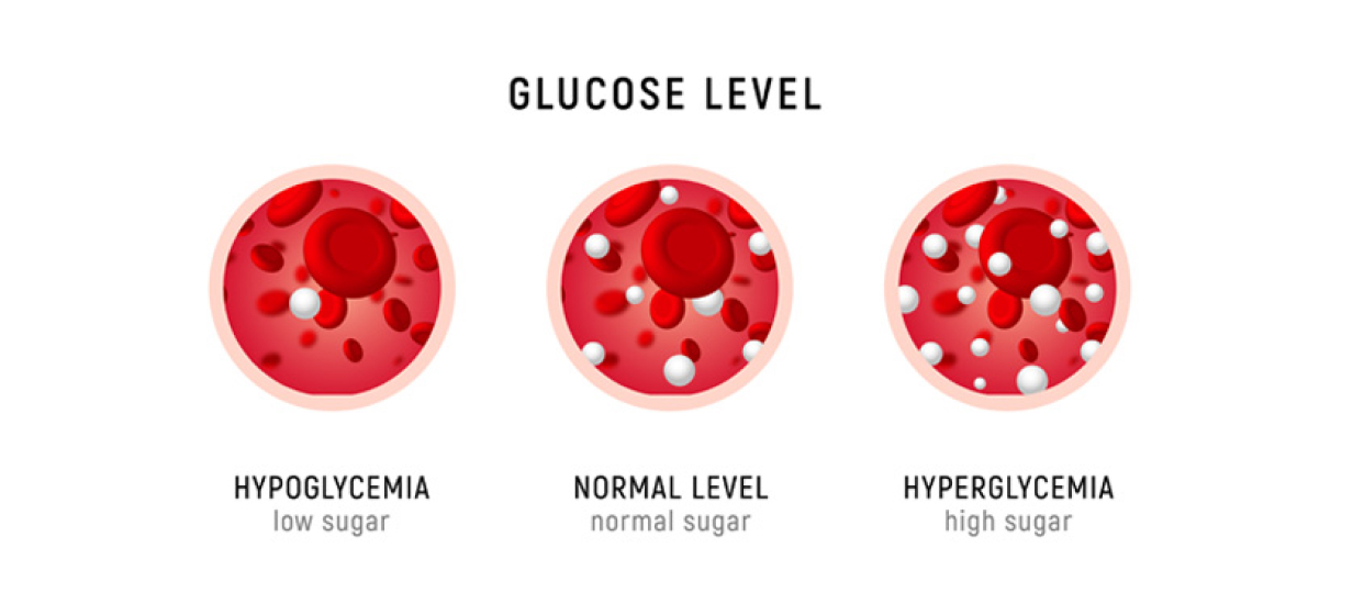 What To Do if Blood Glucose is Low