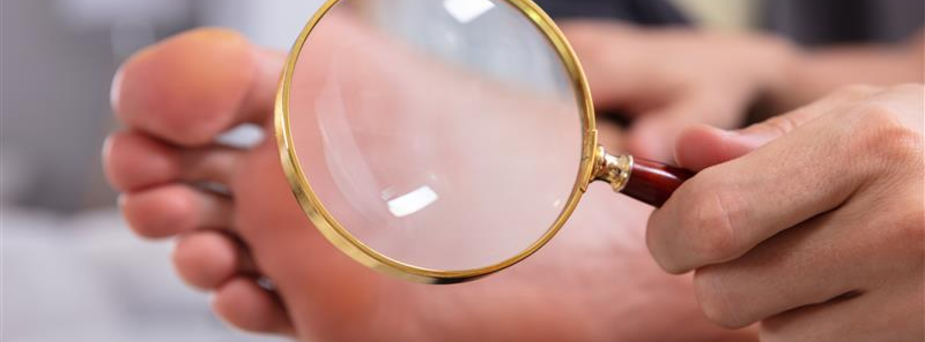 Signs of Foot Problems