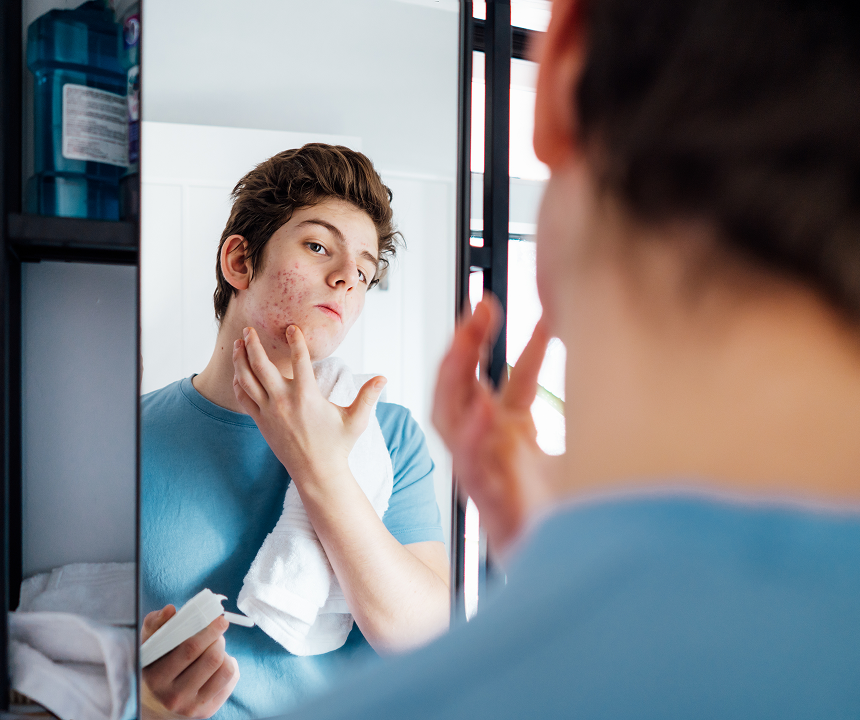 A boy looks at his reflection in a mirror, examining his face closely with a worried expression as he notices acne on his skin